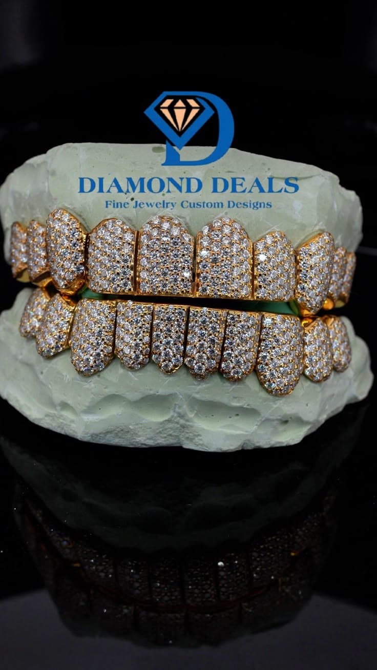 10 Top 10 Bottom Yellow Gold Pavé Grillz