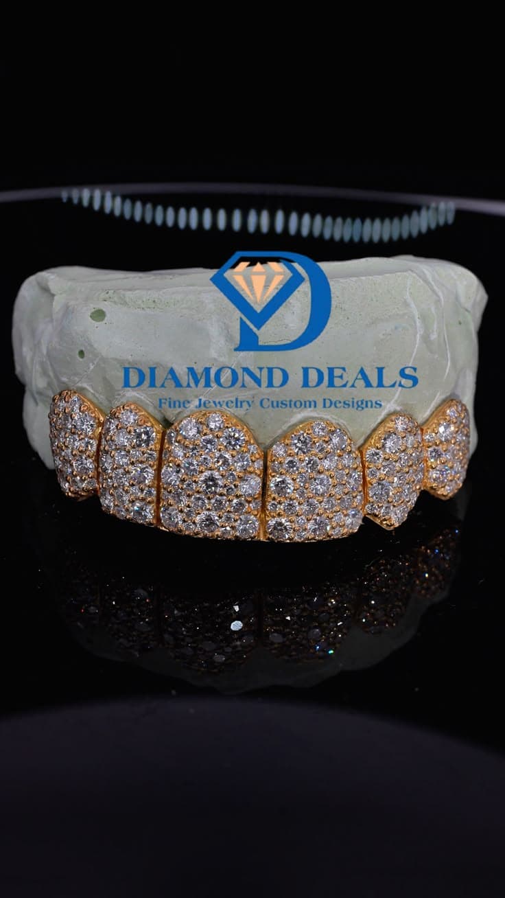 6 Top Yellow Gold Galaxy Set