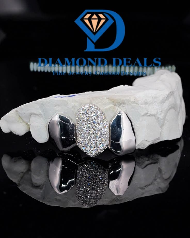 3 Top Custom Iced-Out Center Grillz