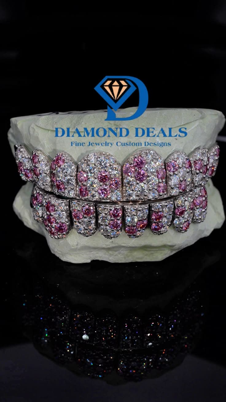 10 Top 10 Bottom Valentine 10pt Jumbo Grillz