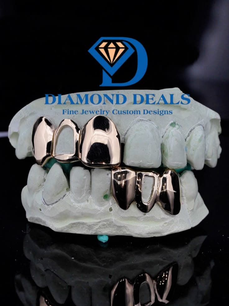 6-Piece Open Face Fang Grillz – Solid Gold Custom Set