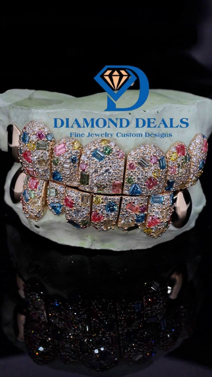 8 Top 8 Bottom 10K Yellow Gold Lab Diamond Galaxy Grillz – Fancy Color & Fancy Shape